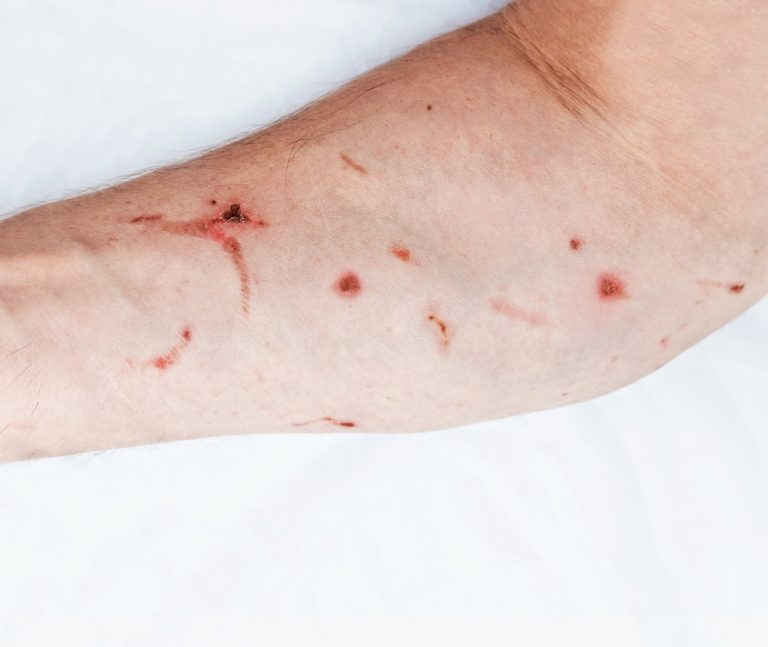 Concerned about Welding Hazards? Westermans Blog